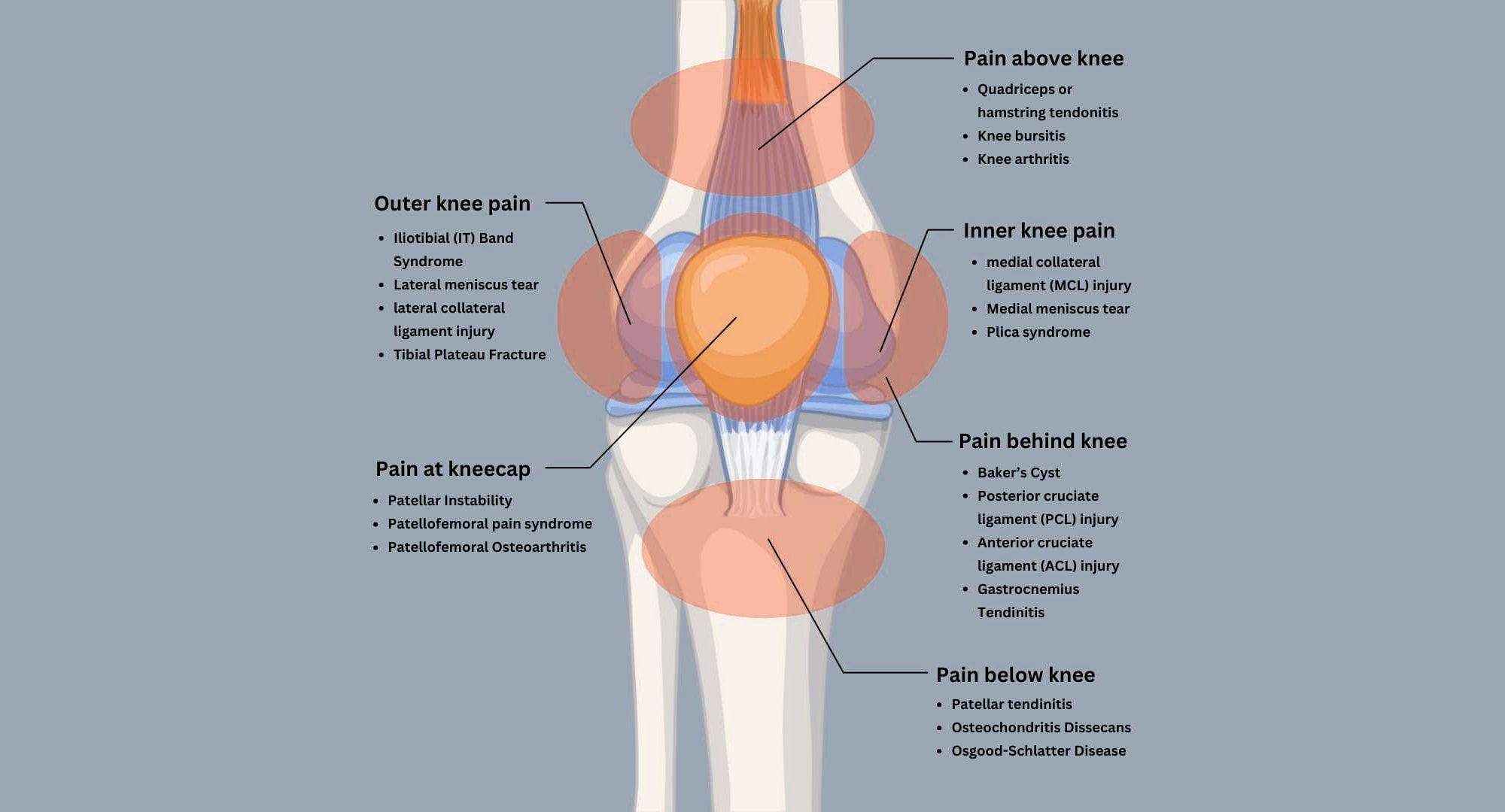 parts of the knee.jpeg